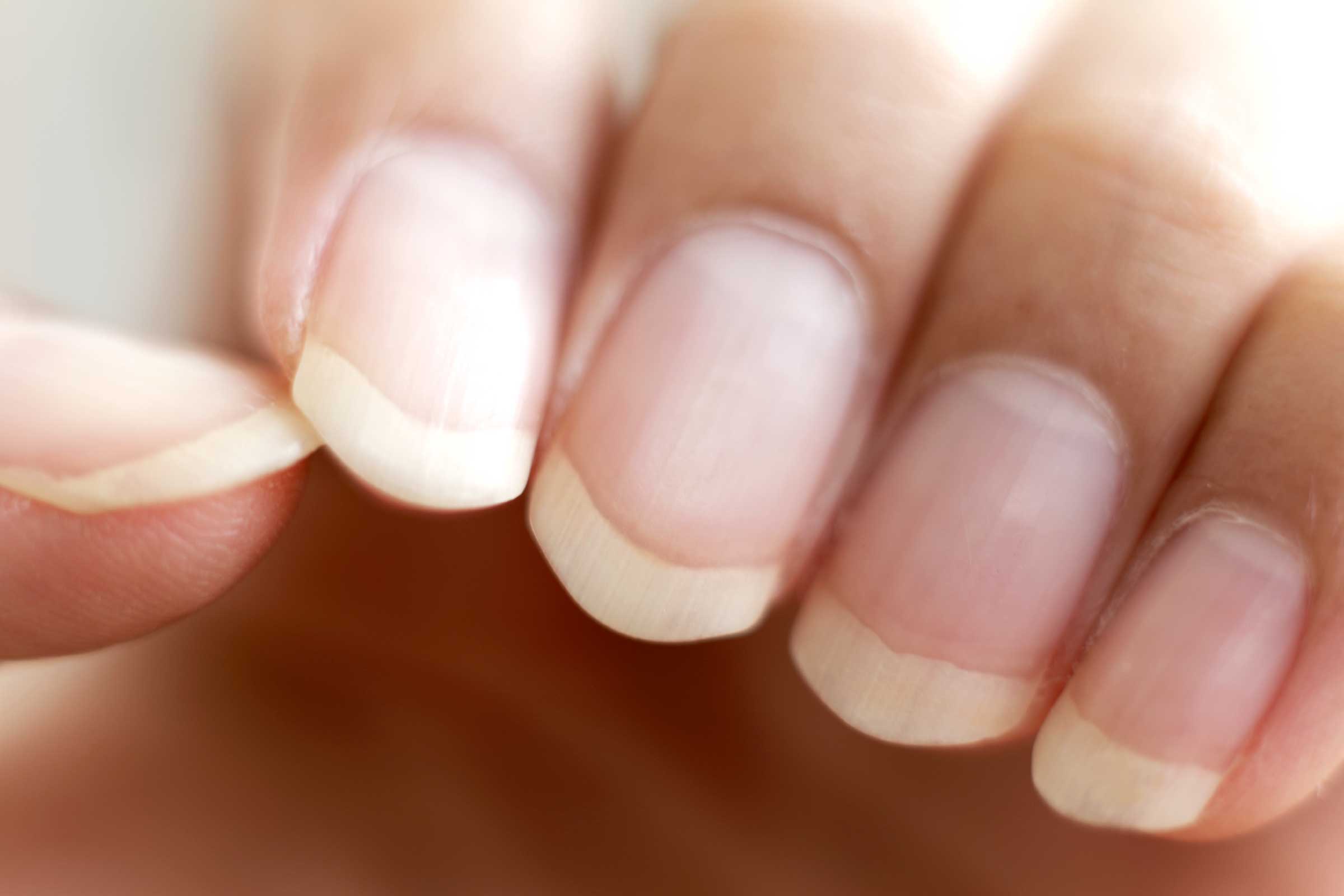 What is the Normal Color of a Healthy Nail Bed? - wide 6