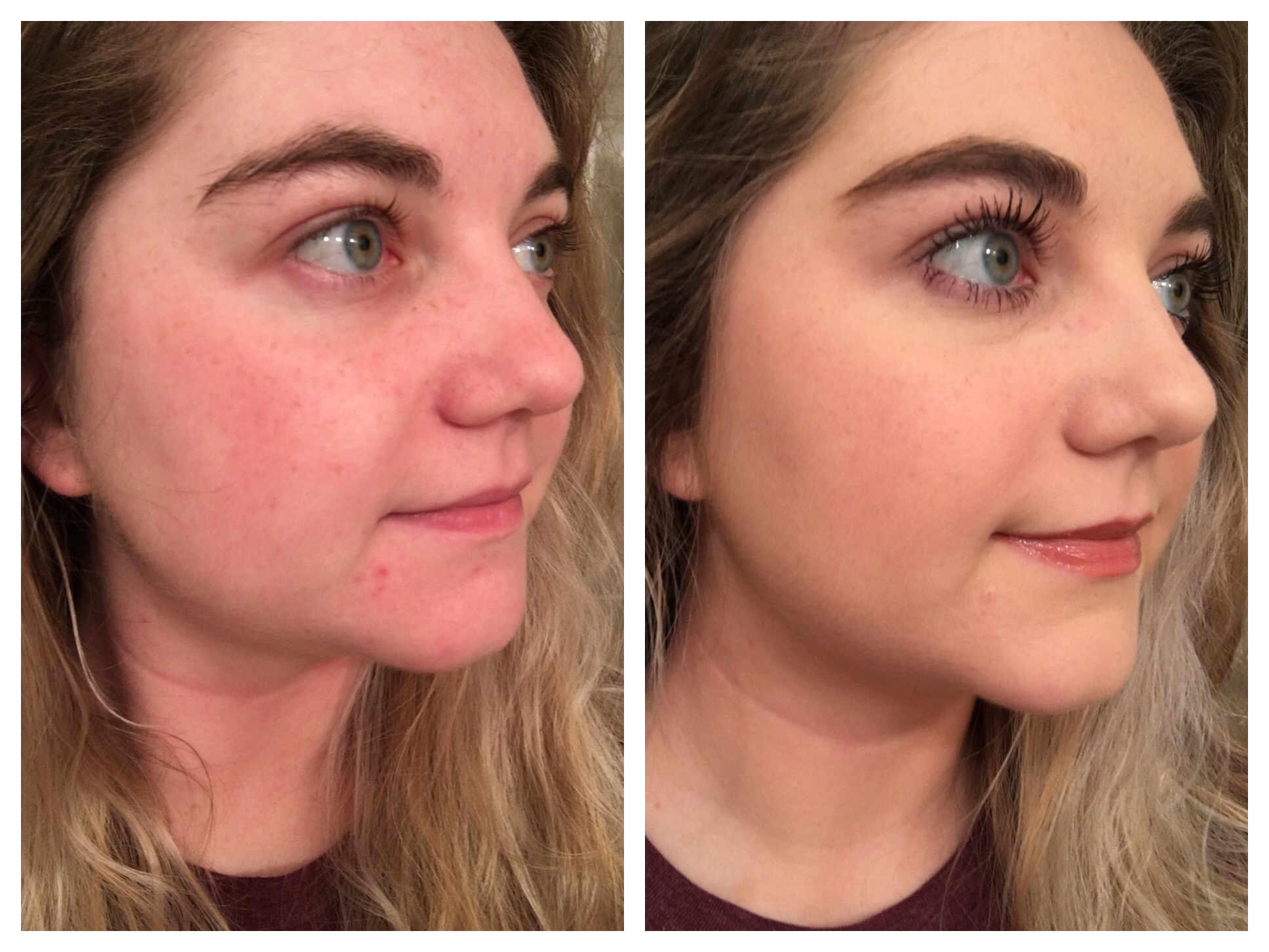 permanent concealer before and after
