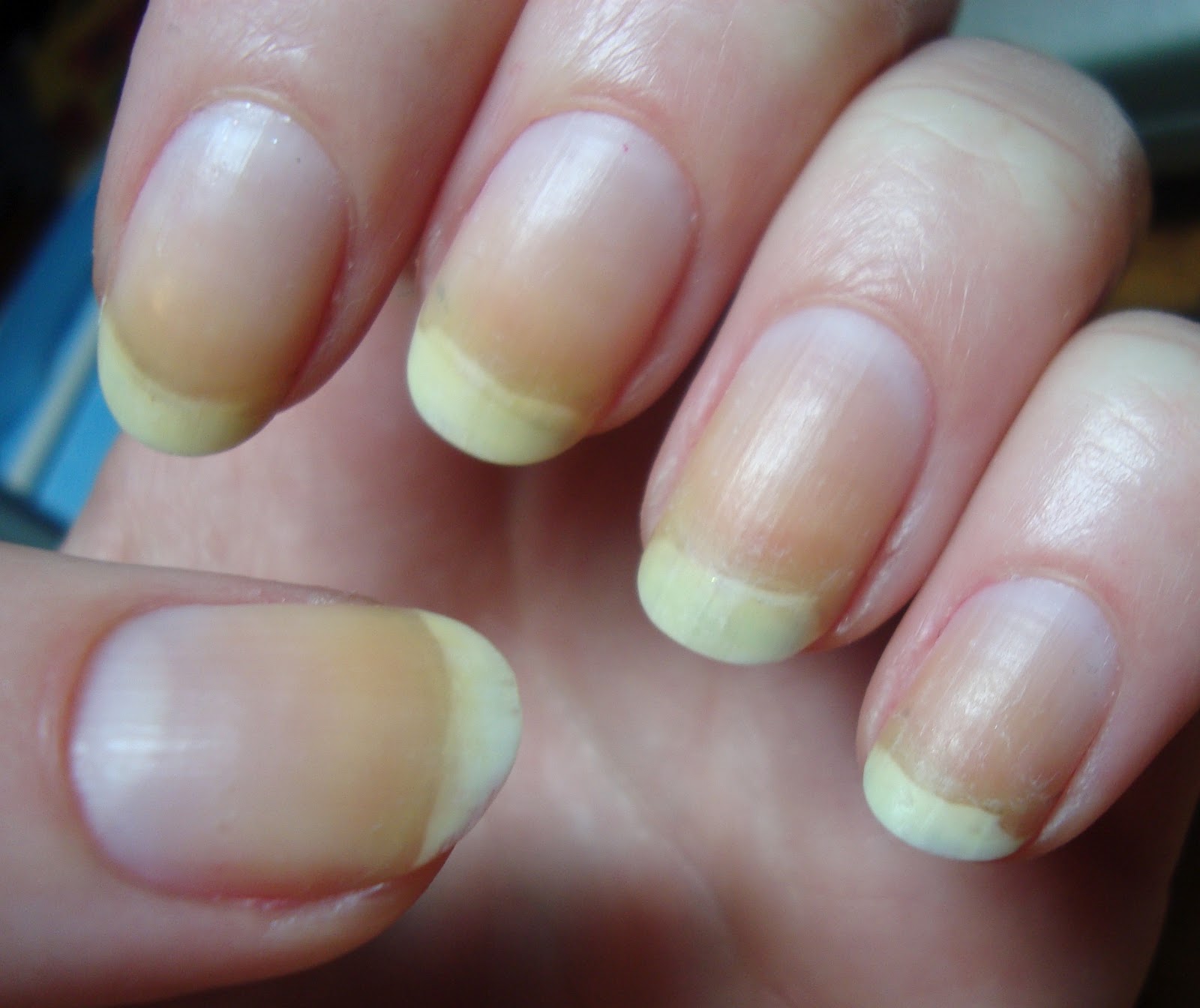 How To Whiten Yellow Nails