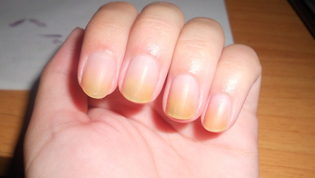 How To Whiten Yellow Nails