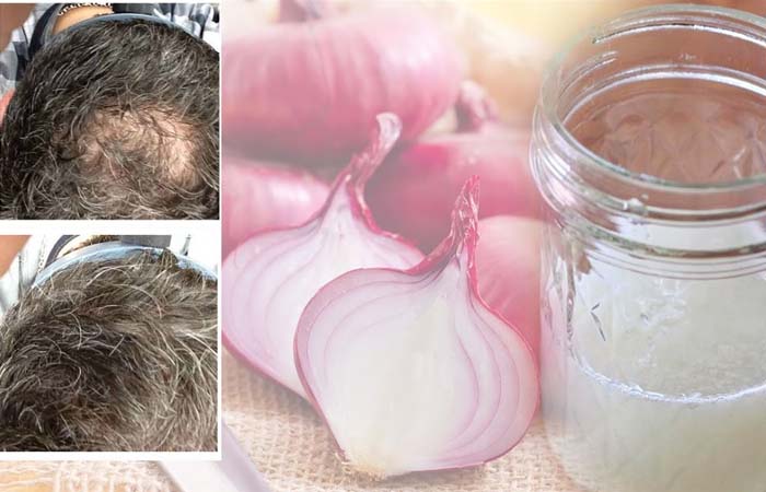 How To Grow Hair Faster