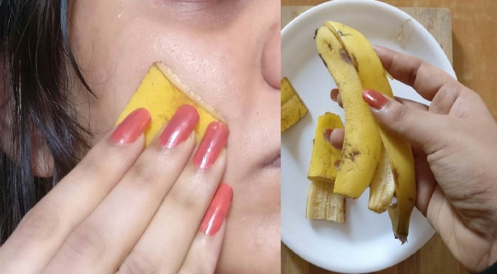 Banana peel cures pimples