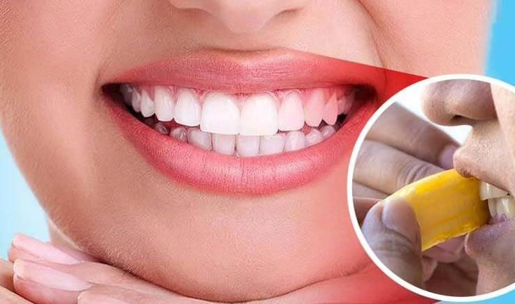 banana peel for Whiten Teeth