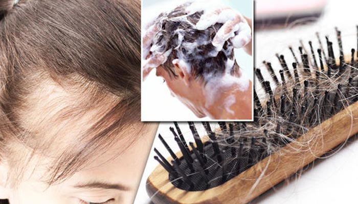 Hair loss by shampoos
