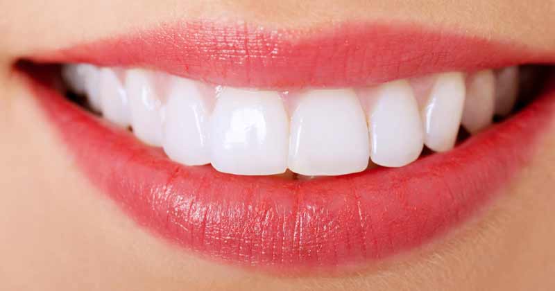 How-to-get-white-teeth