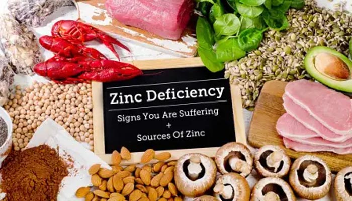 hair loss by Zinc deficiency