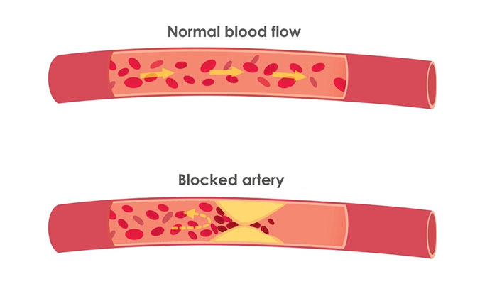 Effects of Cholesterol on Body