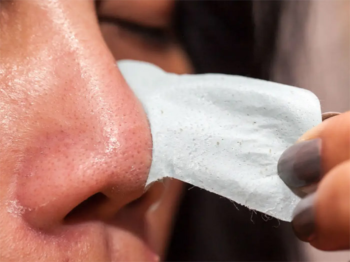 How to cure blackheads