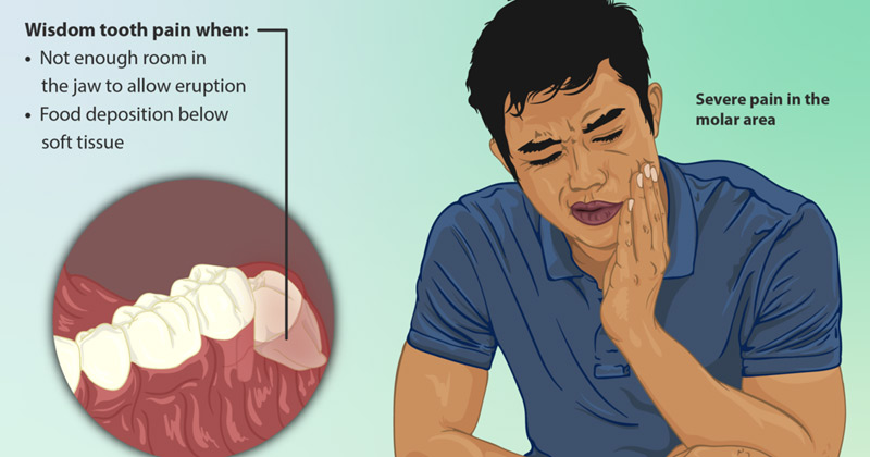 Man In Pain | Home Remedies For Wisdom Tooth Ache