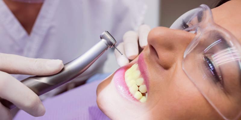 Causes of Yellow Teeth | Tips For Teeth Whitening