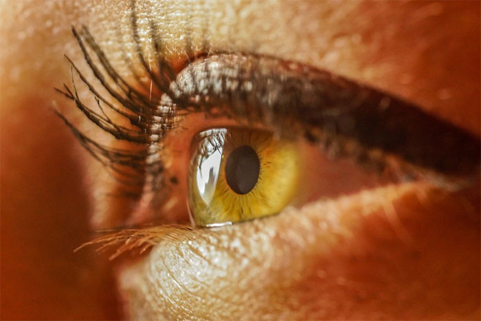 What Causes Eye Color to Change in Adults