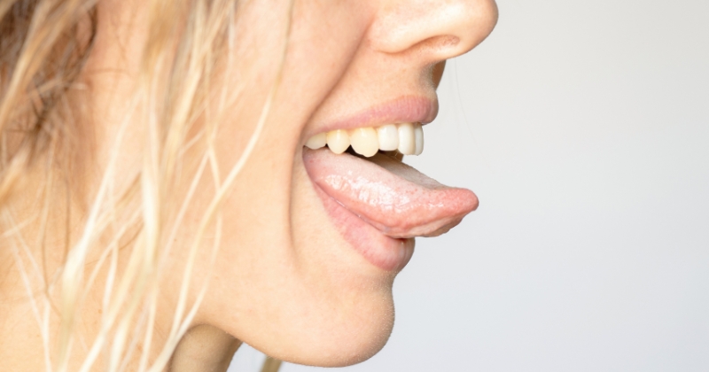 What Is White Tongue: Causes, Treatement & Prevention