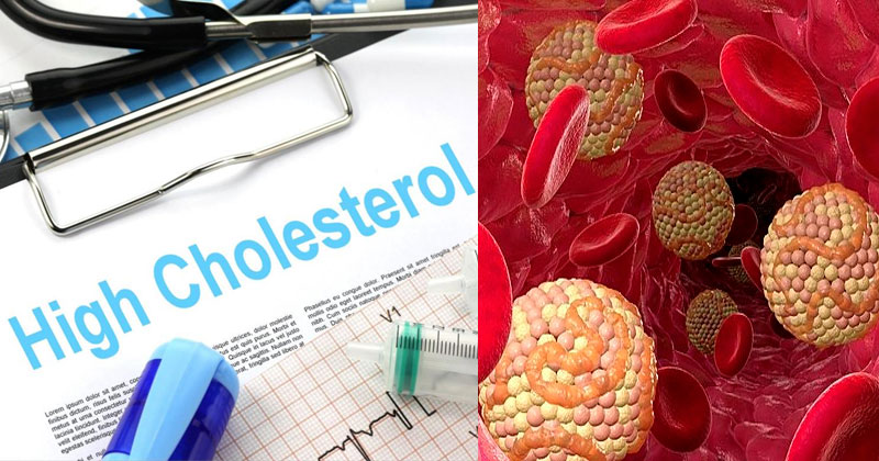 Normal Cholesterol Level