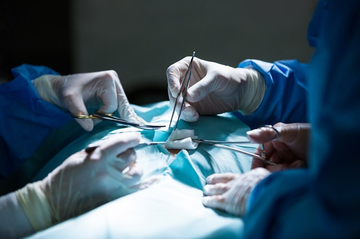 hernia surgery